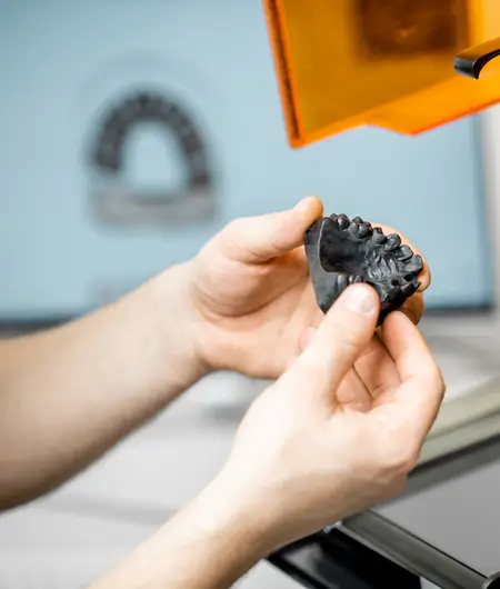 Impresoras 3D para protesis dentales